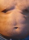 Χημειοθεραπεία για τους... παχύσαρκους