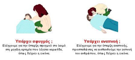 Καρδιακή ανακοπή