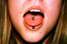 Tongue Piercing: Βλάπτει σοβαρά την υγεία!