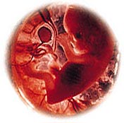 Ελεγχος χρωμοσωμάτων σε έμβρυα λίγων ημερών
