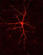 Ανθρώπινα νευρικά κύτταρα στον εγκέφαλο ποντικών