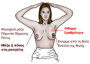 Ας μιλήσουμε για τον καρκίνο του μαστού