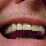 Τι είναι η Στοματολογία – Παθολογία του Στόματος