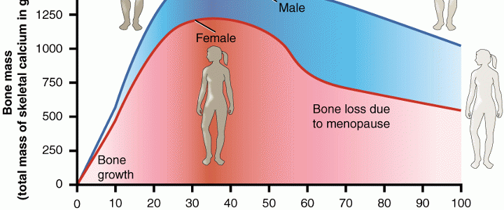 Read more about the article Γιατί η οστεοπόρωση προτιμά τις γυναίκες;