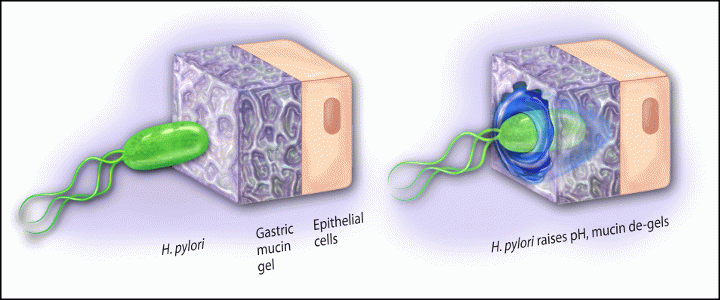 You are currently viewing Τι είναι το Helicobacter pylori;