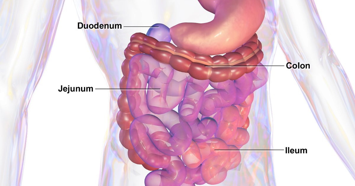 Read more about the article ΝΟΣΟΣ ΤΟΥ CROHN