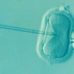 Προεμφυτευτική διάγνωση: Έγκαιρη διάγνωση γενετικών παθήσεων πριν την εγκυμοσύνη