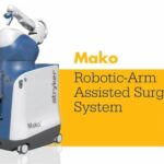 6 Οφέλη της Αρθροπλαστικής με Ρομποτικό Βραχίονα Mako